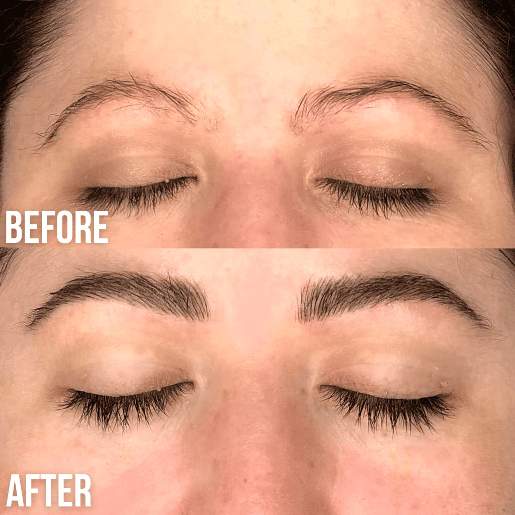 Luxe Serum Bundle Set - Image 5